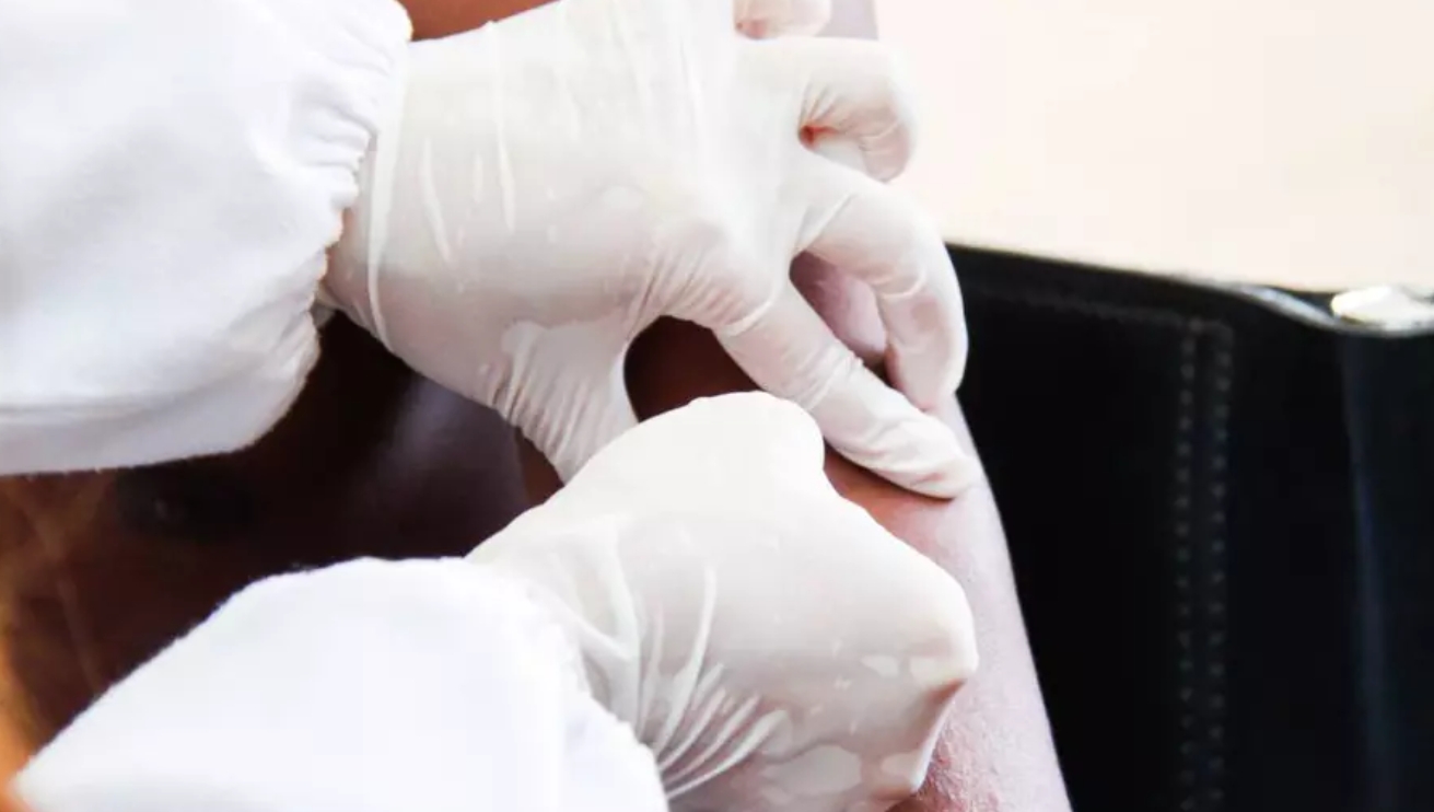 Unde s-a îmbolnăvit una dintre femeile cu lepră din Cluj-Napoca: țara este o destinație turistică foarte populară 1